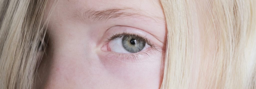 oculoplastica bambini minori dai 3 anni