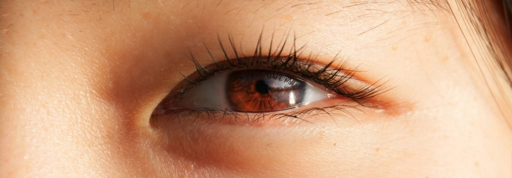 occhio di donna orientale con Ptosi Pazienti Orientali
