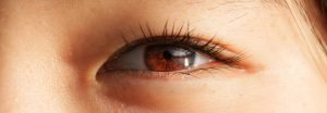 occhio di donna orientale con Ptosi Pazienti Orientali