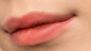 Filler labbra Russian lips
