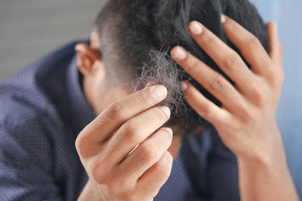 seffihair alopecia